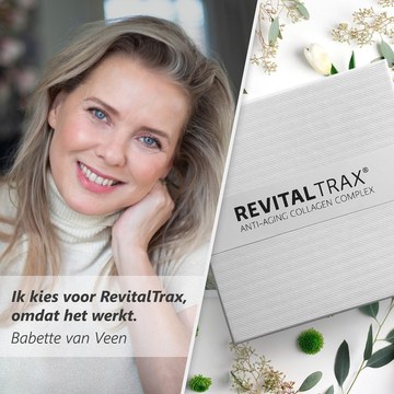 Babette van Veen - Emst Event and Shoot Collection in babettevanveenofficial_2181373900104128149_4755009.jpg - hidden celebrity photo